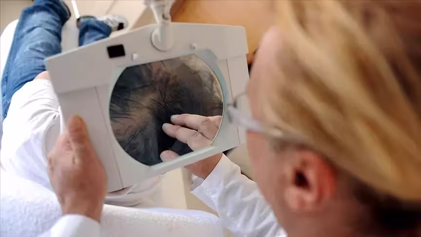 Dermatologist inspecting a patient's scalp through a magnifying lens