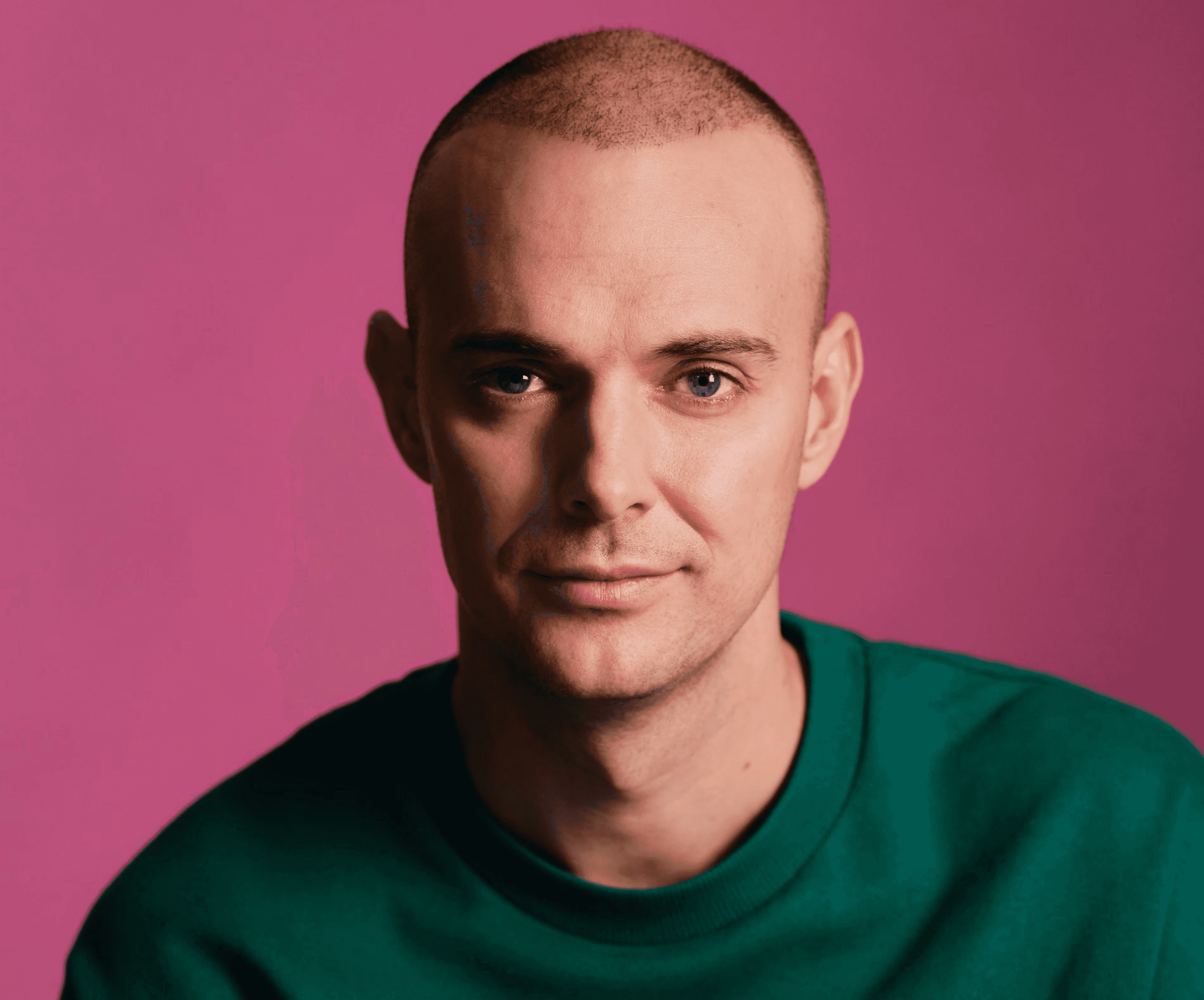 I have not been seen in public without a hat for 10 years. Would a Turkish hair transplant change my life?