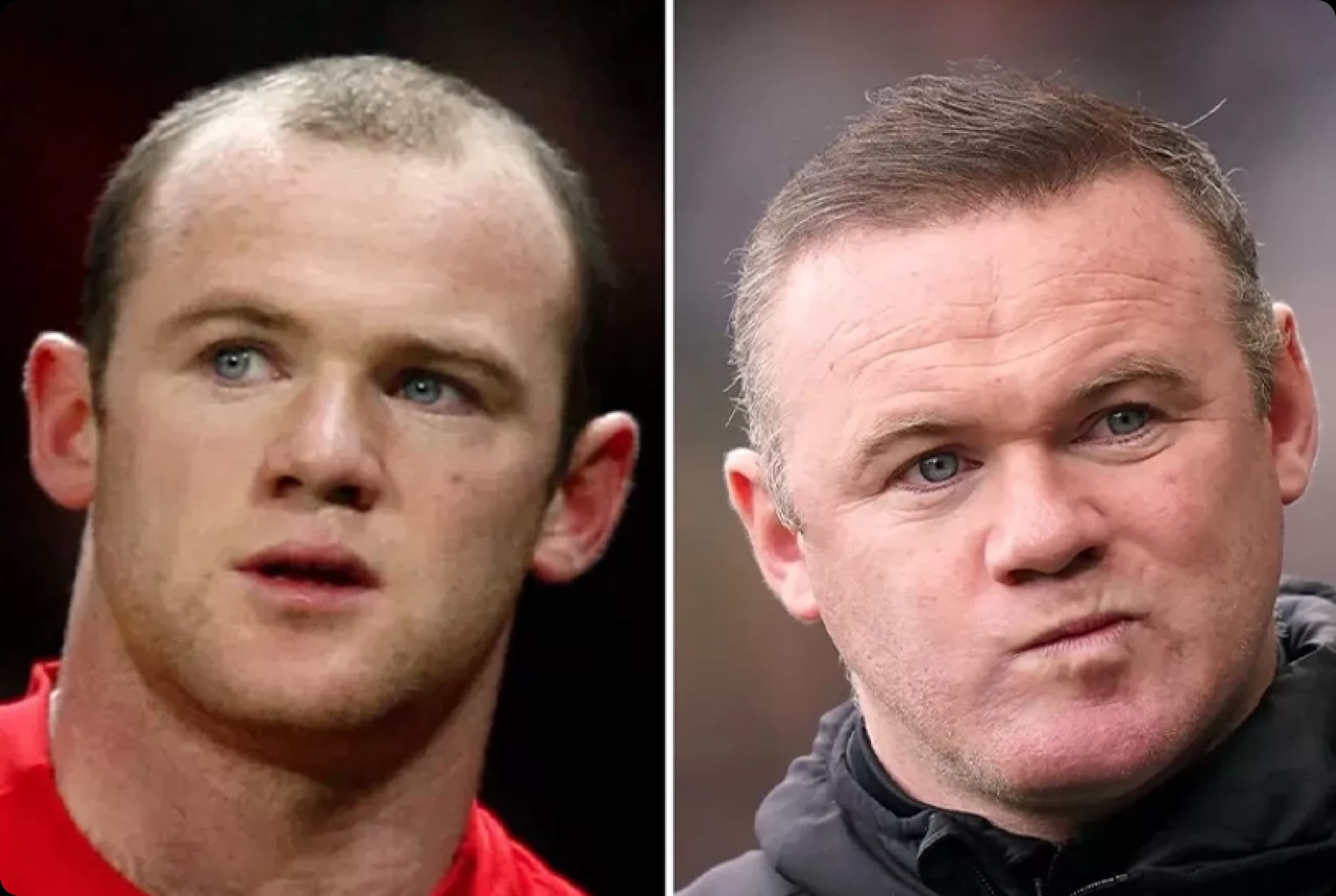 Wayne Rooney before and after treatment