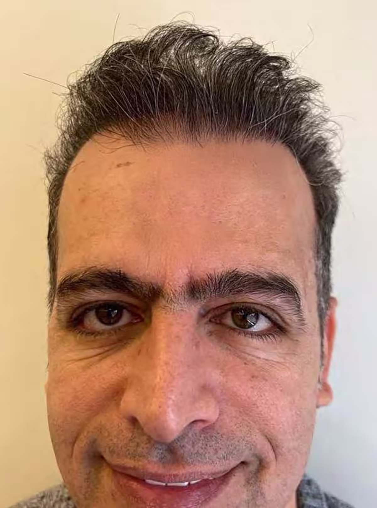 After transformation